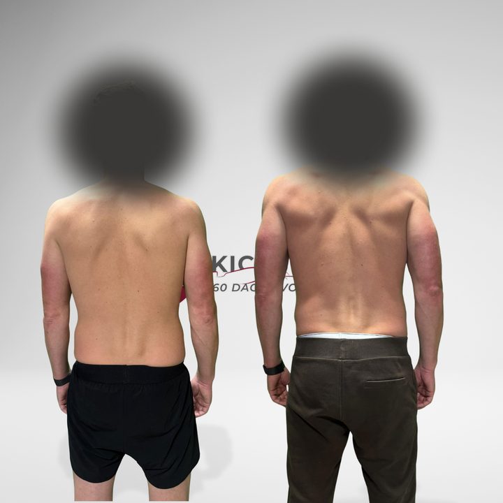 Kickstarter bij start en finish